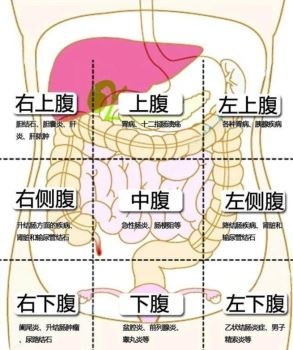 一张图简单辨别腹痛还是胃痛(含常见疾病)，