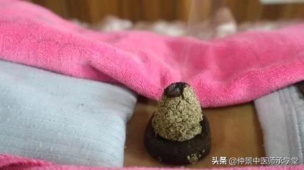 艾灸温阳有余，阴阳两虚怎么办？隔中药灸可以弥补艾灸的局限性