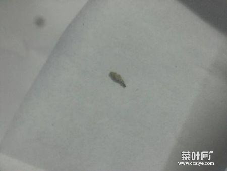 身上有洞有虫恶心图片 各种恶心重口图片