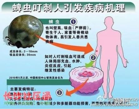 强行把蜱虫拔下来有啥危险 蜱虫为啥不能直接拔