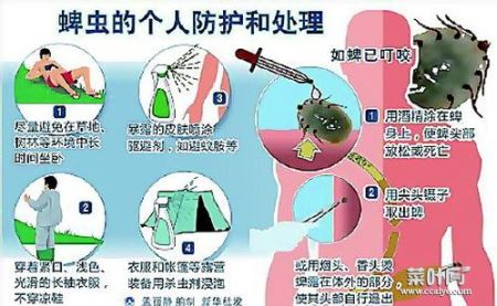 风油精治蜱虫么 蜱虫叮咬后如何治