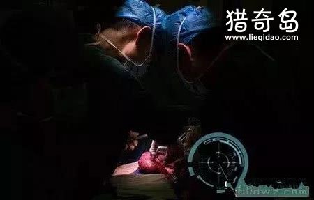 器官移植后记忆转移？器官移植真的会有细胞记忆吗？