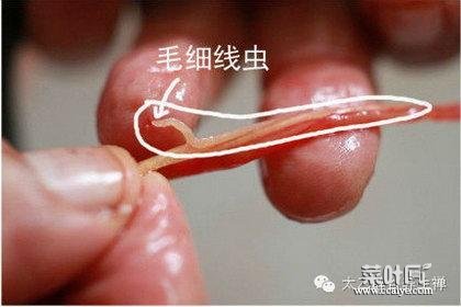 胃里有虫子图片 马陆虫子图片