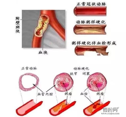 感觉全身血管在跳动如何回事 全身感觉冷如何回事