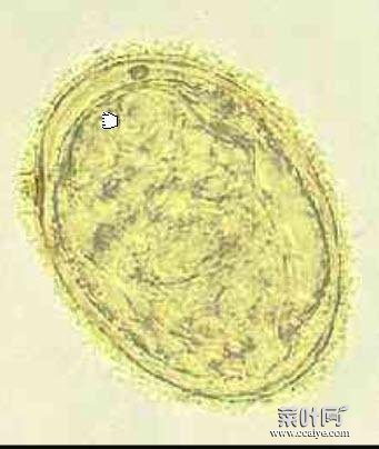 日本分体吸虫结构图 日本分体吸虫的发育需要中间宿主