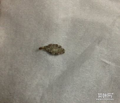 感觉浑身痒有虫爬的感觉 如何判断床上有螨虫