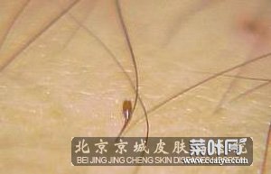 阴虱大小跟啥差不多 和6s差不多大小的手机