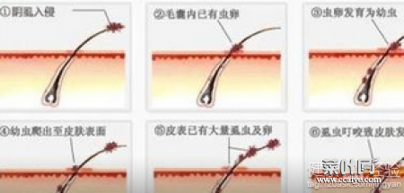 阴虱大小跟啥差不多 和6s差不多大小的手机