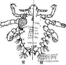 阴虱如何除不了根 阴虱最怕啥