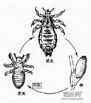 阴虱如何除不了根 阴虱最怕啥