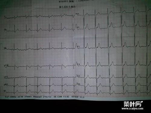 心率高于100说明啥 心跳过快如何缓解