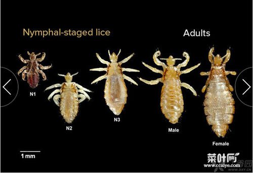 阴虱卵最多多少天会变成若虫 阴虱能捉干净吗