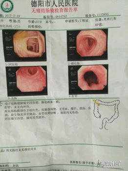 下腹部按着特别硬 右下腹按压感觉有硬物