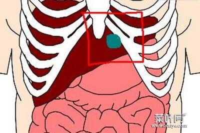 肋骨一按就疼怎么回事 左下肋骨一个点按压痛