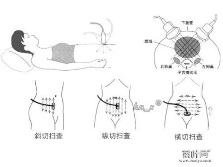 按压肚子有轻微疼痛 按压小肚子有轻微疼痛