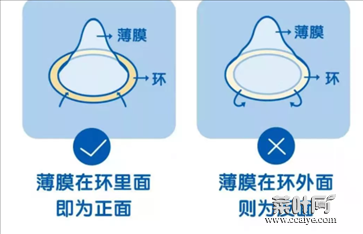 避孕套一定要全程使用吗 正确使用安全套的做法