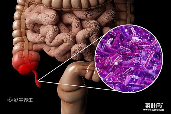 阑尾炎的疼痛位置 阑尾炎疼痛怎么缓解