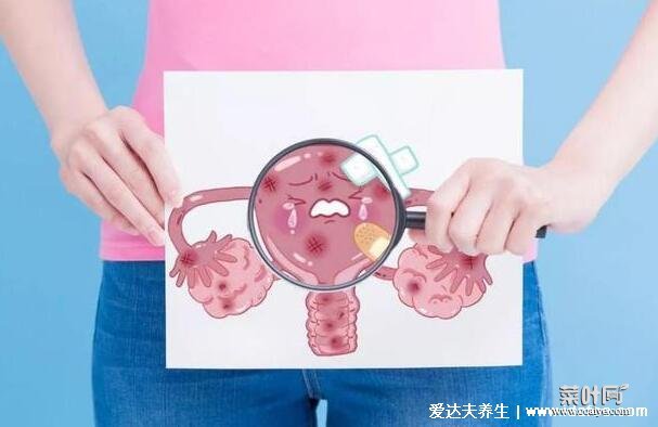 为什么医生不建议打hpv，因为10种情况不能打宫颈癌疫苗