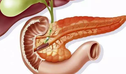 得了胰腺炎后要一辈子忌口吗3