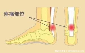 脚踝各个部位疼痛图解，脚底疼痛部位图解