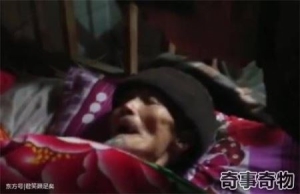 女子三次死而复生 是波尔兹曼大脑在作怪