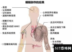 11天不睡觉啥感觉？英国“怪蜀黍”告诉你