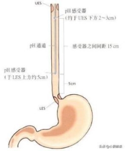 老鹰吃了极毒的蛇为什么不中毒？