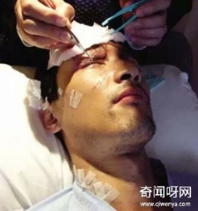 胡歌车祸诡异事件，车祸现场胡歌手机自动拨打求救电话