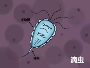 什么是滴虫性花园炎 感染滴虫性花园炎的症状及医治预防