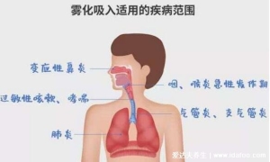 做一次雾化伤一次肺吗，为何很多医生不建议雾化(利弊分析)