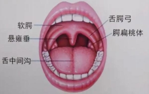 扁桃体炎症状有哪些？咽炎和扁桃体炎的症状分别是什么？