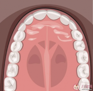 后牙槽上有黑线是什么 窝沟封闭可以预防窝沟龋坏是真的吗