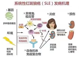 红斑狼疮的早期症状及图片