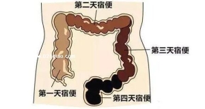 世界上最长的粑粑，长达1.8米重达26斤的超级大便(被博物馆收藏)