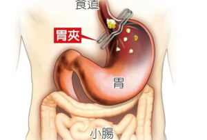 胃在什么位置图片：左上腹肋骨以下(体型不同位置不同)