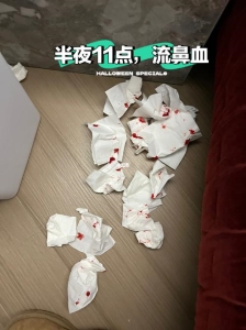 无故流鼻血是什么原因