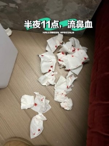 无故流鼻血是什么原因(经常流鼻血什么原因)