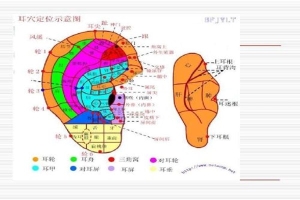 什么是耳穴埋豆 耳穴埋豆的注意事项