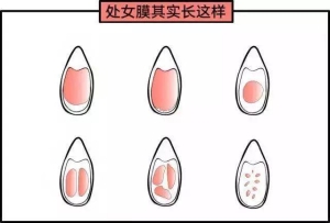 女性阴部真实照片：健康女人真实完美阴道及处女膜解剖学图片【多图】