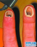 这么恶心的空手指图片你们见过吗？其实这是恶搞