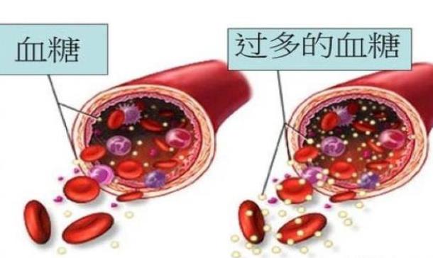 糖化血红蛋白高多少是糖尿病 糖化血红蛋白多少正常